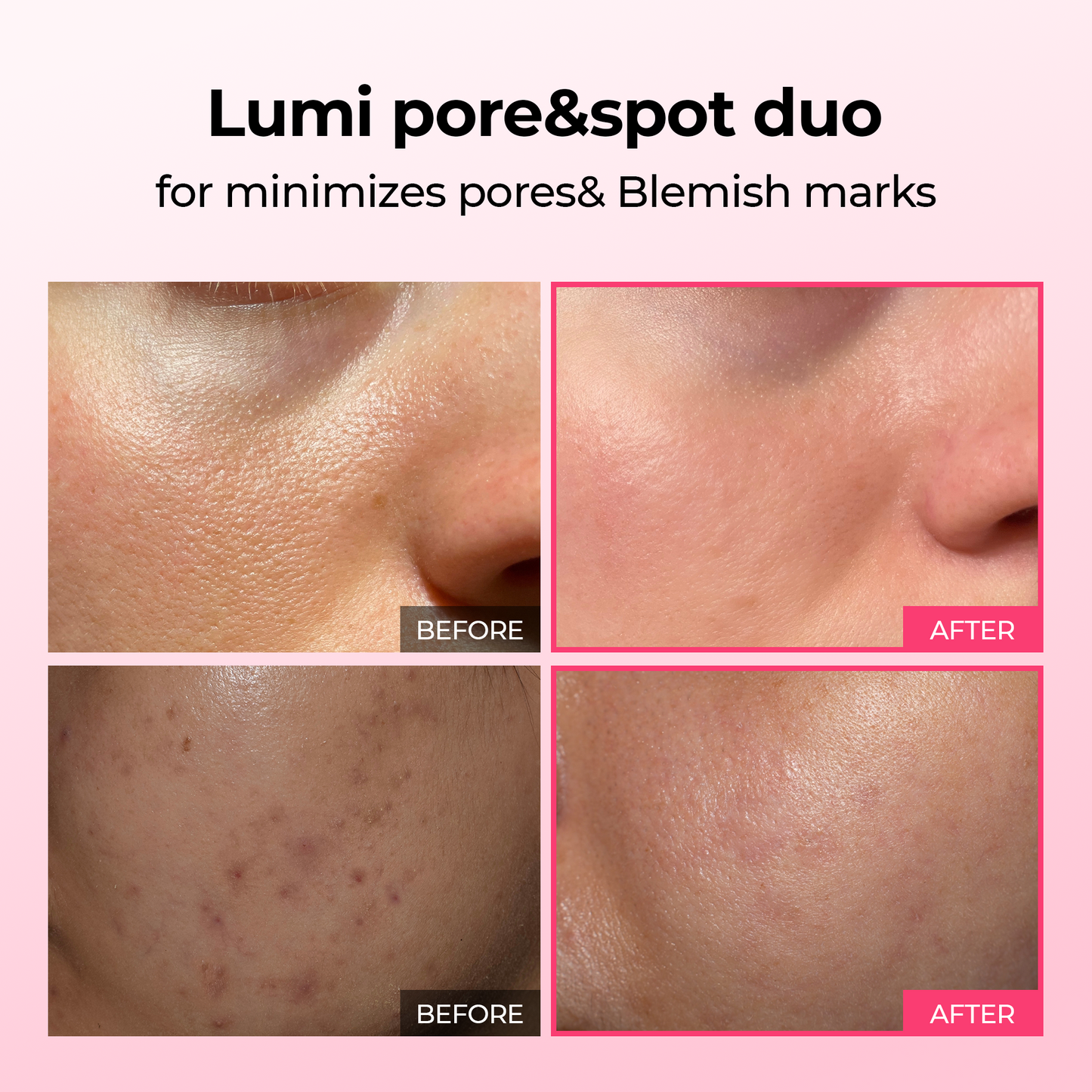 Dr.Melaxin 4-Piece Skincare Set – Peel Shot Rice Ampoule Duo (White + Black) & Lumi Firm Lift Care Duo, Exfoliating, Brightening & Firming Kit for Smooth, Lifted & Radiant Skin